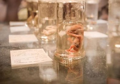 公布广州中山大学附属第一医院试管费用明细，附试管成功率因素分析