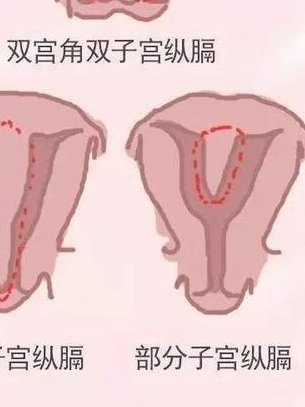 做了结扎手术可以在新市区试管医院做试管婴儿吗？费用是多少