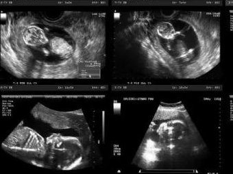 2026年株洲市中心医院怎么样？能不能做三代试管看完就知道