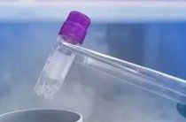 2026年单身Karaganda做三代试管的成功率有多高？该如何做试管