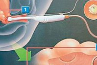 泰国试管婴儿医院成功率排行榜，6大医院
